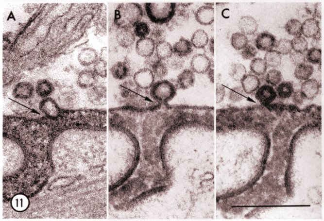 Electron Microscopy: vesicle recycling on the spot