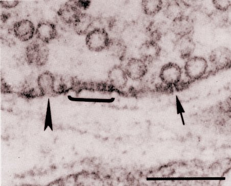 Electron Microscopy after Quick Freezing